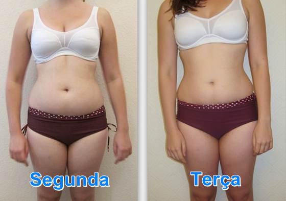 antes-depois-pilates-2